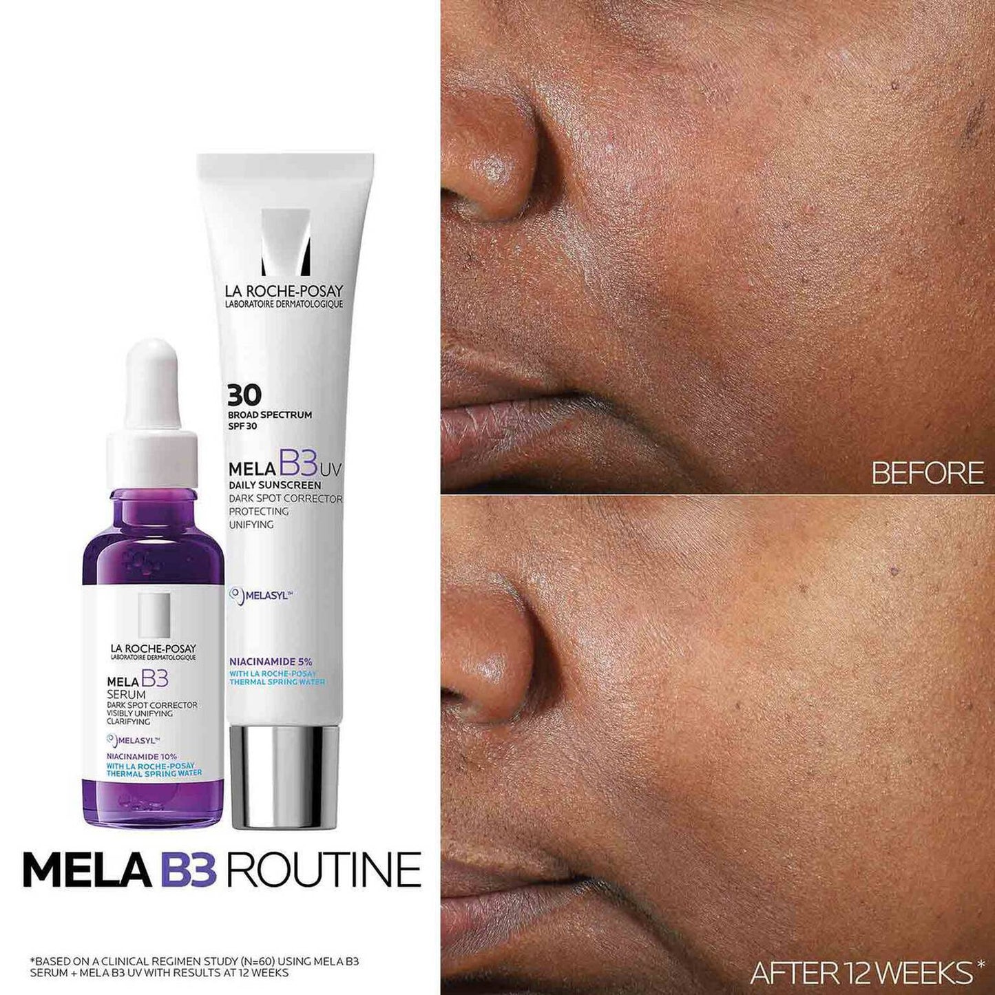 mela-b3-dark-spot-serum-and-mela-b3-uv-daily-moisturizer-with-spf-30-p0 3-Mela-B3-routine_1500X1500.jpg