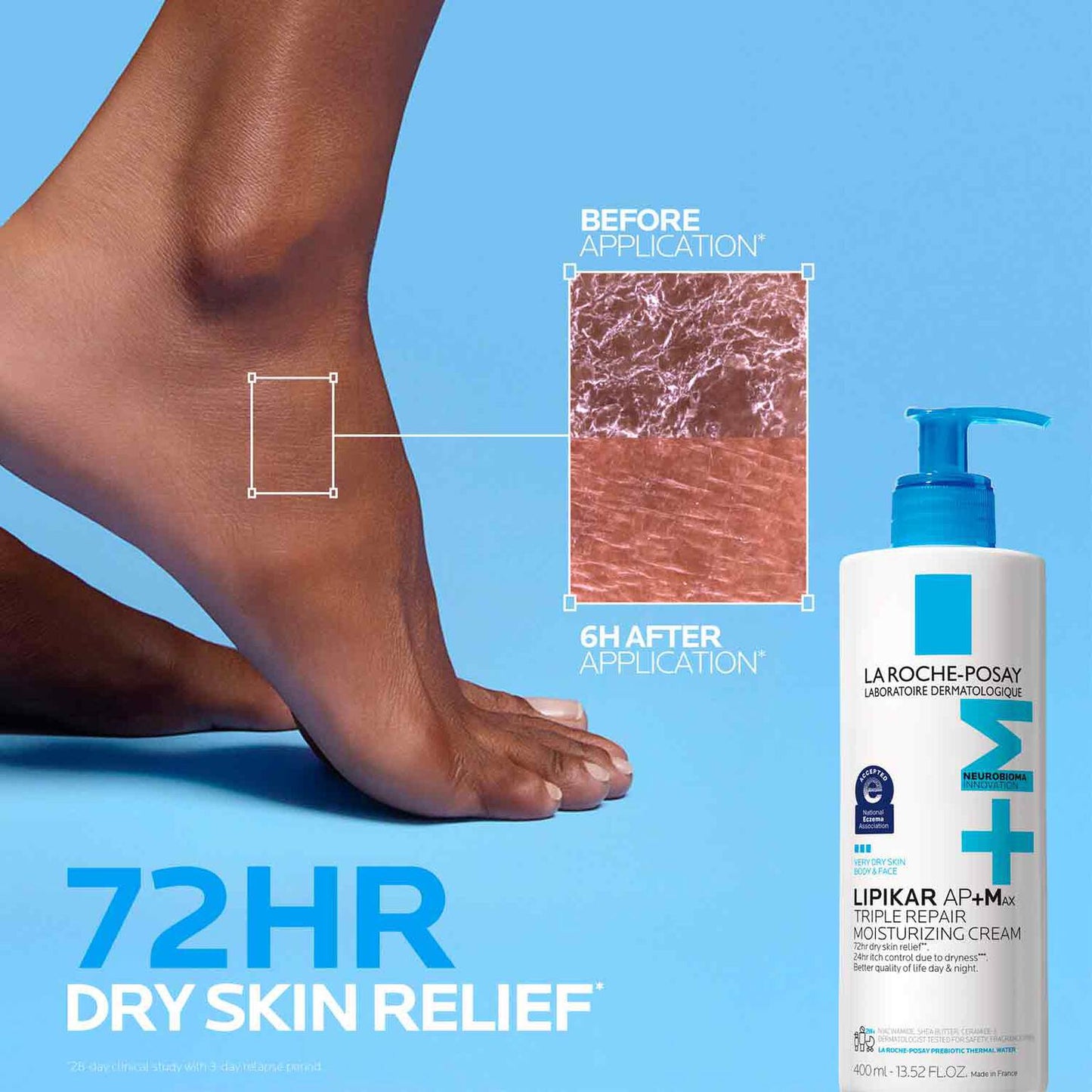lipikar-ap-max-triple-repair-moisturizing-cream-k1 LaRochePosay-Product-Skincare-Lipikar-Balm-AP+MAX-400ml-3337875941150-ATF-PIM-BeforeAfter.jpg