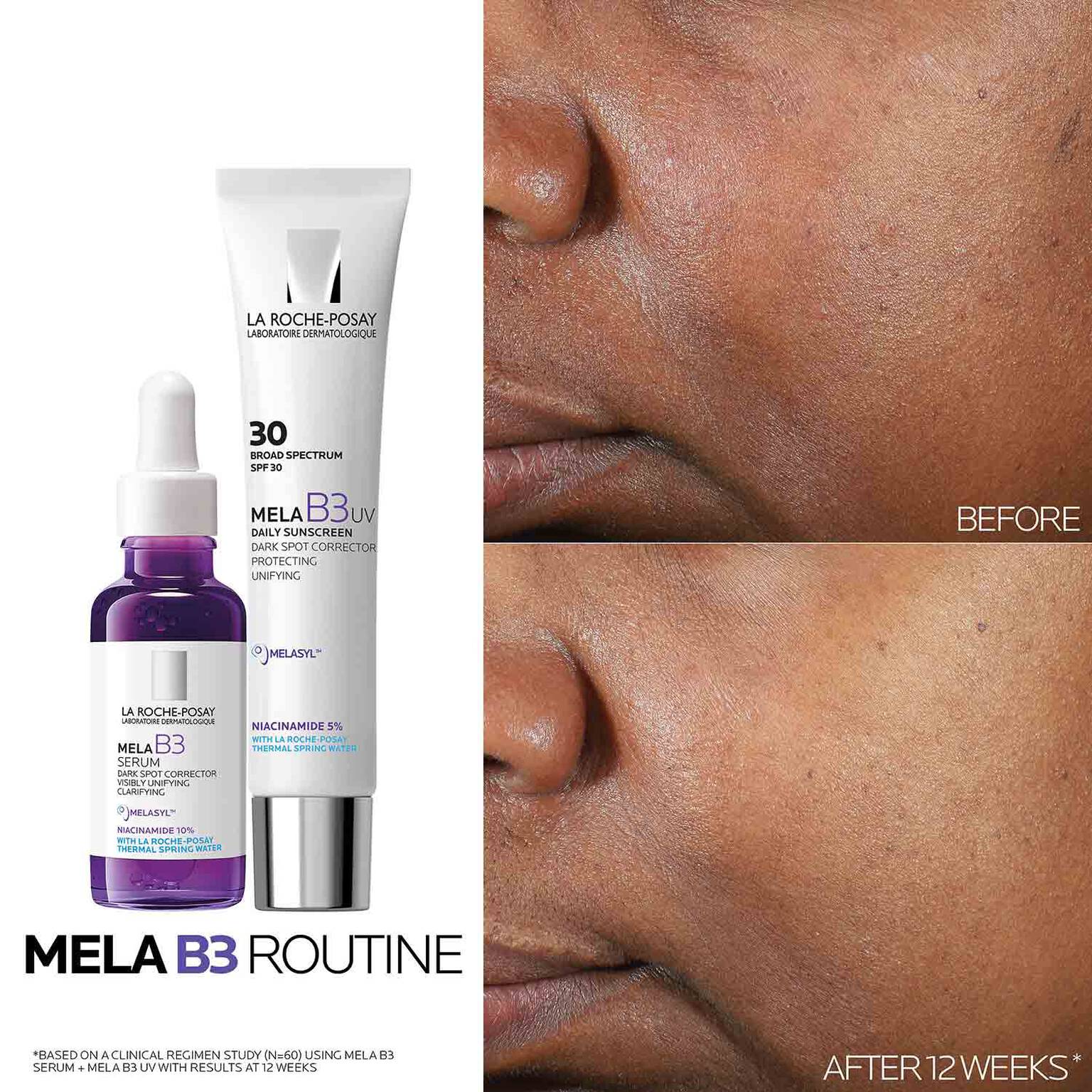 mela-b3-dark-spot-serum-with-melasyltm-niacinamide-g1 Mela-B3-routine_1500X1500.jpg